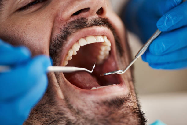 Best Commercial Dentistry  in Wheeler, TX